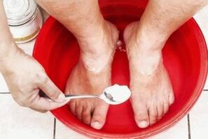 Un bagno con soda e sapone di catrame eliminerà il fungo sulle gambe